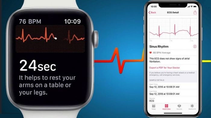 Apple Watch теперь с функцией ЄКГ